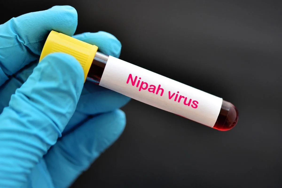 Awas! Wabah Virus Nipah di India Picu Kewaspadaan, Kemenkes Tingkatkan Pantauan dan Pencegahan